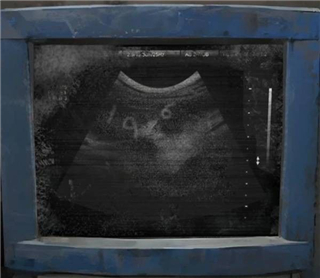 纸嫁衣8千子树手机版