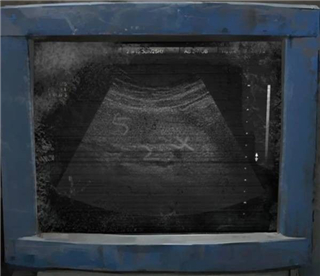 纸嫁衣8千子树手机版