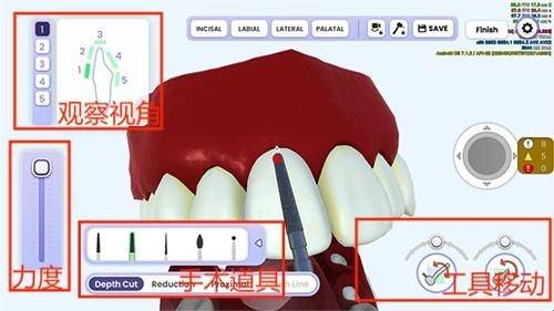 牙医模拟器